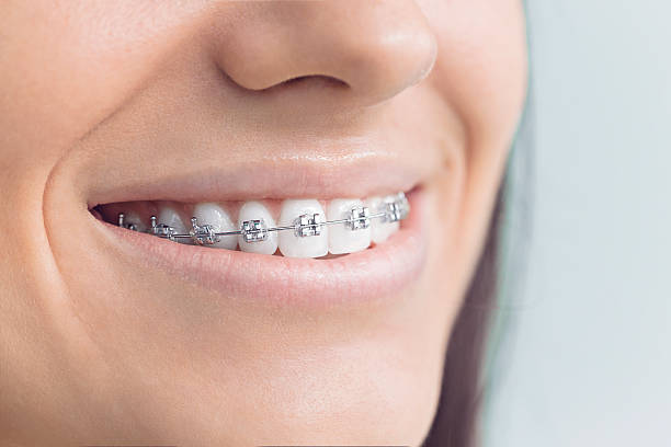 Best Tooth Extraction  in Wetumpka, AL
